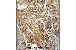 Immunohistochemistry (Paraffin-embedded Sections) (IHC (p)) image for anti-Colony Stimulating Factor 2 (Granulocyte-Macrophage) (CSF2) (AA 59-85) antibody (ABIN654647)