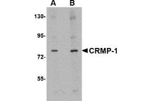 Western Blotting (WB) image for anti-Collapsin Response Mediator Protein 1 (CRMP1) (N-Term) antibody (ABIN1031328)