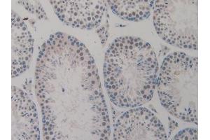 TICAM1 antibody  (AA 263-526)