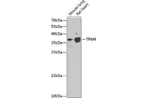 Western blot analysis of extracts of various cell lines using TPM4 Polyclonal Antibody at dilution of 1:1000. (Tropomyosin 4 antibody)