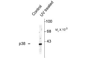 Western blots of HeLa cell lysates that had been treated with UV or untreated (Control) showing specific immunolabeling of the ~39k p38 MAPK protein phosphorylated at Thr180 and Tyr182 . (MAPK14 antibody  (pThr180, pTyr182))