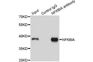 Immunoprecipitation analysis of 150ug extracts of A549 cells using 3ug NFKBIA antibody. (NFKBIA antibody)