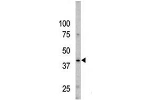 The anti-Phospho-Caspase 9- Pab (ABIN389526 and ABIN2839575) is used in Western blot to detect Phospho-Caspase 9- in Y79 cell line lysates. (Caspase 9 antibody  (pSer196))