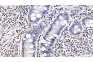 Detection of IGFBP3 in Human Small intestine Tissue using Monoclonal Antibody to Insulin Like Growth Factor Binding Protein 3 (IGFBP3) (IGFBP3 antibody  (AA 135-277))