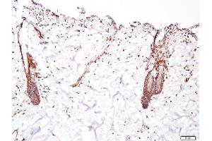 Paraformaldehyde-fixed, paraffin embedded human skin, Antigen retrieval by boiling in sodium citrate buffer (pH6. (FGFR2 antibody  (AA 21-120))