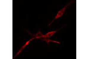 ABIN6274519 staining Hela cells by IF/ICC. (DCP1A antibody  (Internal Region))
