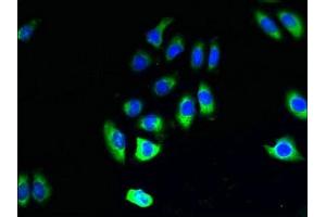 Immunofluorescent analysis of A549 cells using ABIN7154340 at dilution of 1:100 and Alexa Fluor 488-congugated AffiniPure Goat Anti-Rabbit IgG(H+L) (PIGO antibody  (AA 219-420))