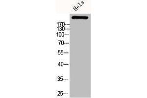 Western Blot analysis of HELA cells using Phospho-ACCα (S80) Polyclonal Antibody