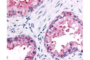 Immunohistochemical staining of Prostate (Epithelium) using anti- OR51E2 antibody ABIN122638 (PSGR antibody  (N-Term))