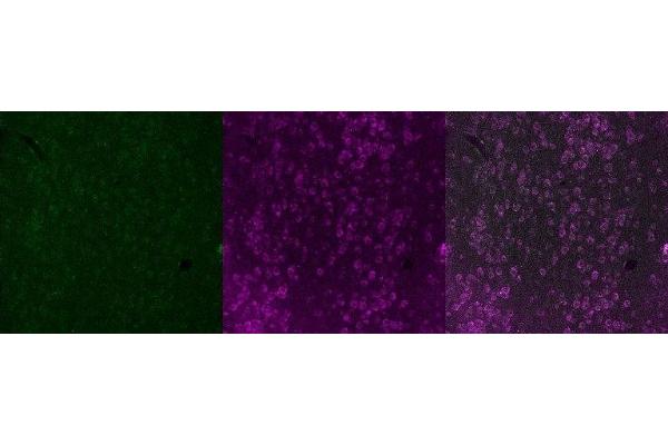 Tryptophan Hydroxylase 2 antibody
