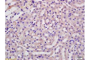 Formalin-fixed and paraffin embedded rat kidney labeled with Anti-P2RX3/ATP receptor Polyclonal Antibody, Unconjugated (ABIN705866) at 1:200 followed by conjugation to the secondary antibody and DAB staining. (P2RX3 antibody  (AA 241-340))