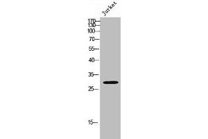 Western Blot analysis of JK cells using Med8 Polyclonal Antibody (MED8 antibody  (Internal Region))