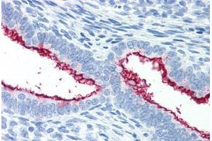 Human Uterus (formalin-fixed, paraffin-embedded) stained with MUC16 antibody ABIN351551 at 10 ug/ml followed by biotinylated anti-mouse IgG secondary antibody ABIN481714, alkaline phosphatase-streptavidin and chromogen. (MUC16 antibody)