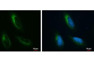 ICC/IF Image Grp78 antibody [N2C1], Internal detects Grp78 protein at endoplasmic reticulum by immunofluorescent analysis.