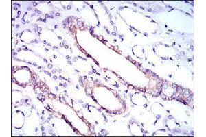 Immunohistochemical analysis of paraffin-embedded kidney tissues using RPL18A mouse mAb with DAB staining. (RPL18A antibody  (AA 50-176))