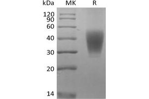 Western Blotting (WB) image for SLAM Family Member 7 (SLAMF7) protein (His tag) (ABIN7321032)