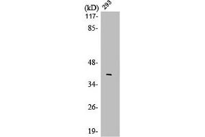 Western Blot analysis of 293 cells using LMO4 Polyclonal Antibody (LMO4 antibody  (C-Term))
