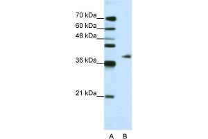 WB Suggested Anti-ADAT1 Antibody Titration:  1. (ADAT1 antibody  (C-Term))