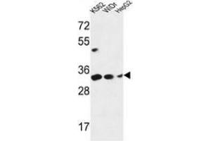 Western blot analysis of PYCR1 (arrow) in K562, WiDr, HepG2 cell line lysates (35ug/lane) using PYCR1  Antibody (C-term). (PYCR1 antibody  (C-Term))