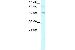 WB Suggested Anti-SEMA4A Antibody Titration: 1. (Sema4a antibody  (N-Term))