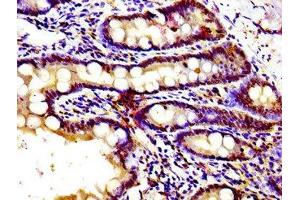 Immunohistochemistry of paraffin-embedded human small intestine tissue using ABIN7153343 at dilution of 1:100 (GPR39 antibody  (AA 345-453))