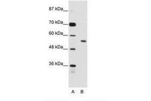 Image no. 1 for anti-Bromodomain Containing 3 (BRD3) (N-Term) antibody (ABIN203206)