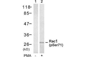 Western blot analysis of extracts from 293 cells untreated(lane 1) or treated with PMA(lane 2) using Rac1(Phospho-Ser71) Antibody. (RAC1 antibody  (pSer71))