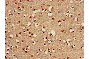 Immunohistochemistry of paraffin-embedded human brain tissue using ABIN7144876 at dilution of 1:100 (ABCA2 antibody  (AA 1223-1429))
