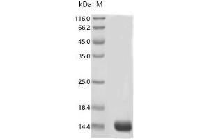 (Tris-Glycine gel) Discontinuous SDS-PAGE (reduced) with 5 % enrichment gel and 15 % separation gel.