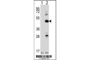 Western blot analysis of ILK using rabbit polyclonal ILK Antibody (pS246) using 293 cell lysates (2 ug/lane) either nontransfected (Lane 1) or transiently transfected (Lane 2) with the ILK gene. (ILK antibody  (AA 225-253))