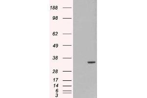 HEK293 overexpressing ORC6L and probed with ABIN2564290 (mock transfection in first lane). (ORC6 antibody  (C-Term))
