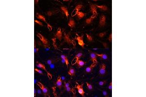 Immunofluorescence analysis of C6 cells using RNF149 Polyclonal Antibody (ABIN7270062) at dilution of 1:100 (40x lens). (RNF149 antibody  (AA 221-400))