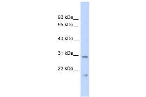 C1orf96 antibody used at 1 ug/ml to detect target protein. (CCSAP antibody  (Middle Region))