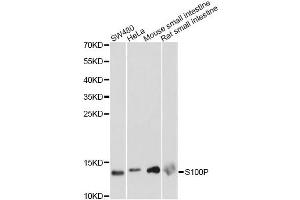 Western blot analysis of extracts of various cell lines, using S100P antibody. (S100P antibody)
