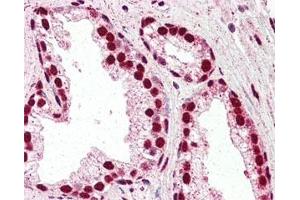 IHC staining of FFPE human prostate tissue with IRF6 antibody at 2. (IRF6 antibody)