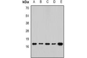 Western blot analysis of RPLP1 expression in SW480 (A), mouse spleen (B), mouse brain (C), rat lung (D), rat liver (E) whole cell lysates. (RPLP1 antibody)