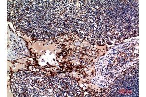 Immunohistochemistry (IHC) analysis of paraffin-embedded Human Lymph, antibody was diluted at 1:100. (TNFSF4 antibody  (Internal Region))
