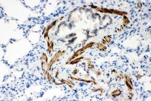 IHC-P: ATP2A2 antibody testing of rat lung tissue (ATP2A2 antibody  (N-Term))