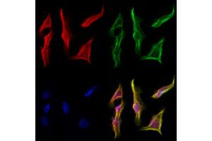 ABIN6257051 and ABIN6274616 staining Hela cells by IF/ICC.