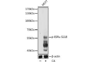 Western blot analysis of extracts of MCF7 cells, using Phospho-ESRα-S118 pAb  at 1:1000 dilution. (Estrogen Receptor alpha antibody  (pSer118))