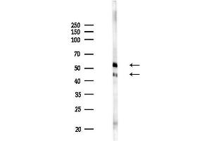 anti-Angiopoietin-Like 4 (ANGPTL4) (N-Term) antibody