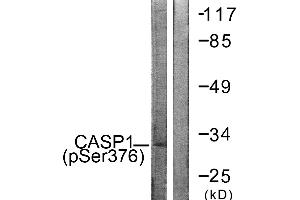 Immunohistochemistry analysis of paraffin-embedded human brain tissue using Caspase 1 (Phospho-Ser376) antibody. (Caspase 1 antibody  (pSer376))