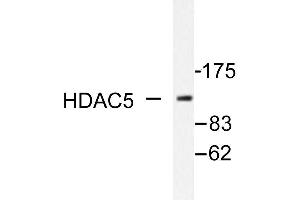 Image no. 1 for anti-Histone Deacetylase 5 (HDAC5) antibody (ABIN271892) (HDAC5 antibody)
