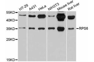 Western blot analysis of extracts of various cell lines, using RPS6 antibody (ABIN5973596) at 1/1000 dilution. (RPS6 antibody)