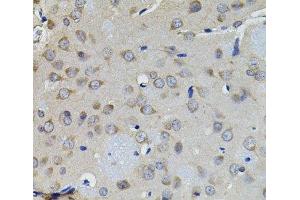 Immunohistochemistry of paraffin-embedded Rat brain using AURKC Polyclonal Antibody (Aurora Kinase C antibody)