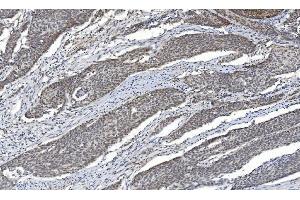 IHC analysis of HDAC5 using anti-HDAC5 antibody (ABIN7599922). (HDAC5 antibody  (AA 13-1107))