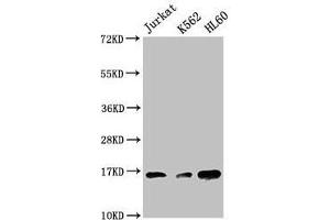 Western Blot Positive WB detected in: Jurkat whole cell lysate, K562 whole cell lysate, HL60 whole cell lysate All lanes: HIST1H3A antibody at 1:500 Secondary Goat polyclonal to rabbit IgG at 1/40000 dilution Predicted band size: 16 kDa Observed band size: 16 kDa (HIST1H3A antibody  (3meLys27))