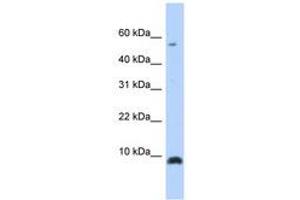 Image no. 1 for anti-Chemokine (C-X-C Motif) Ligand 6 (CXCL6) (C-Term) antibody (ABIN6740256) (CXCL6 antibody  (C-Term))