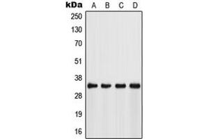 FSBP antibody  (Center)