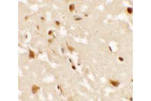 Immunohistochemistry of AIG1 in human brain tissue with AIG1 antibody at 2.